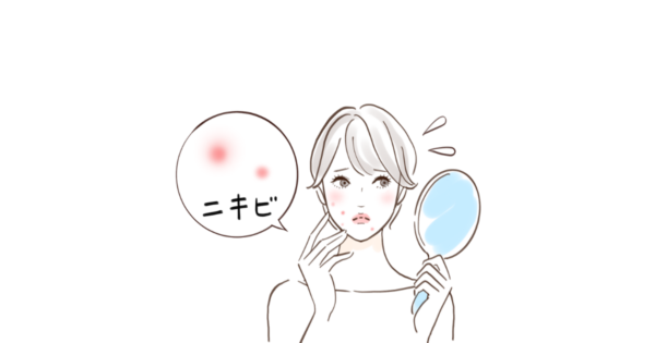 繰り返すニキビに悩む女性と内服ケアの提案画像