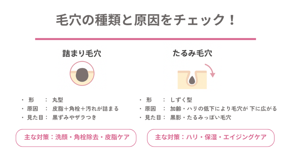 詰まり毛穴とたるみ毛穴の違いと原因、主な対策をイラスト付きで解説した図