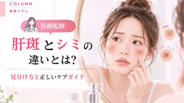 【医師監修】肝斑とシミの違いは？ 見分け方と正しいケア方法を解説サムネイル